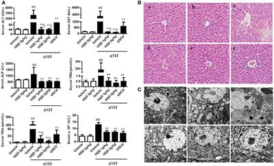 Huangqi Decoction Alleviates Alpha-Naphthylisothiocyanate Induced Intrahepatic Cholestasis by Reversing Disordered Bile Acid and Glutathione Homeostasis in Mice